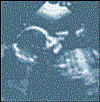 daumenlutschen.gif (11873 Byte)