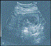 ultraschall4.gif (11642 Byte)
