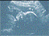 ultraschall5.gif (7711 Byte)